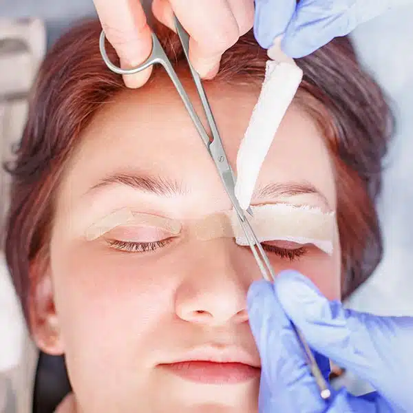 img-drjairbrown-blefaroplastia-panama-2-1697602