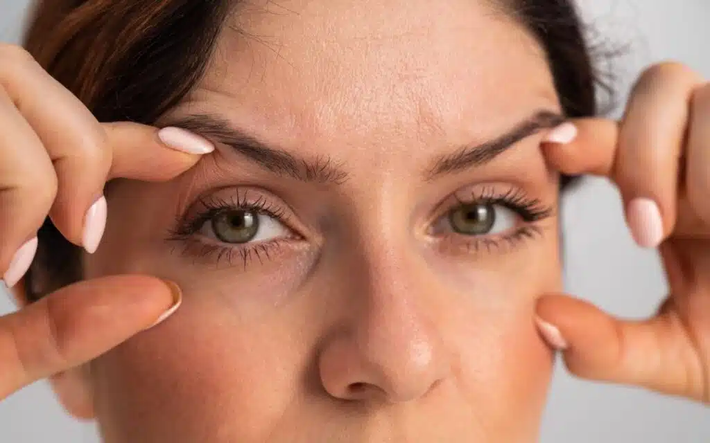beneficios-blefaroplastia-1080x675-5832491