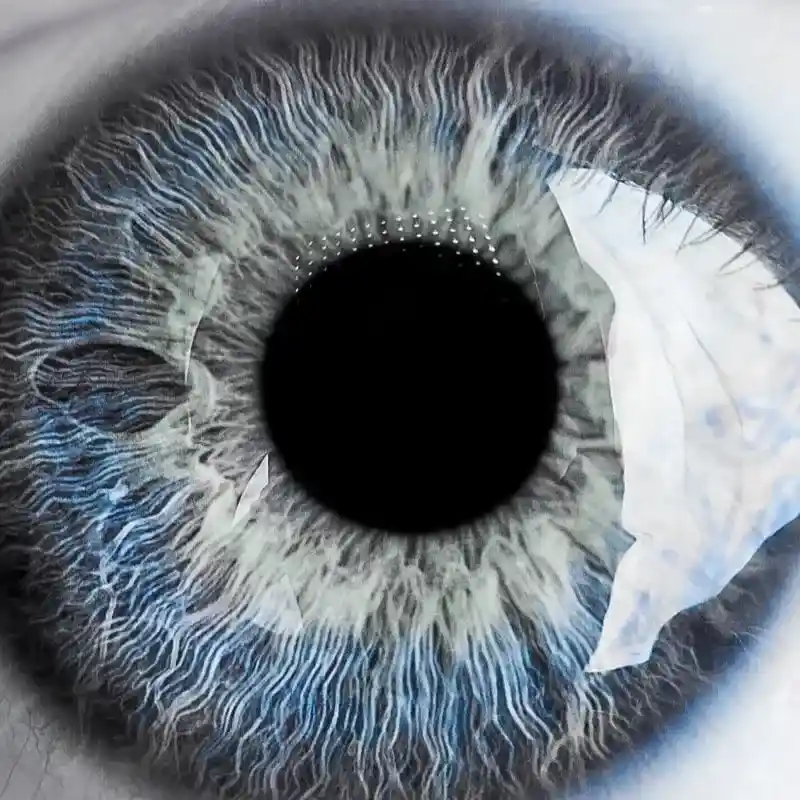 macro-blue-eye-with-lots-of-details-2021-08-26-15-42-17-utc-1-9363881_11zon-3659209